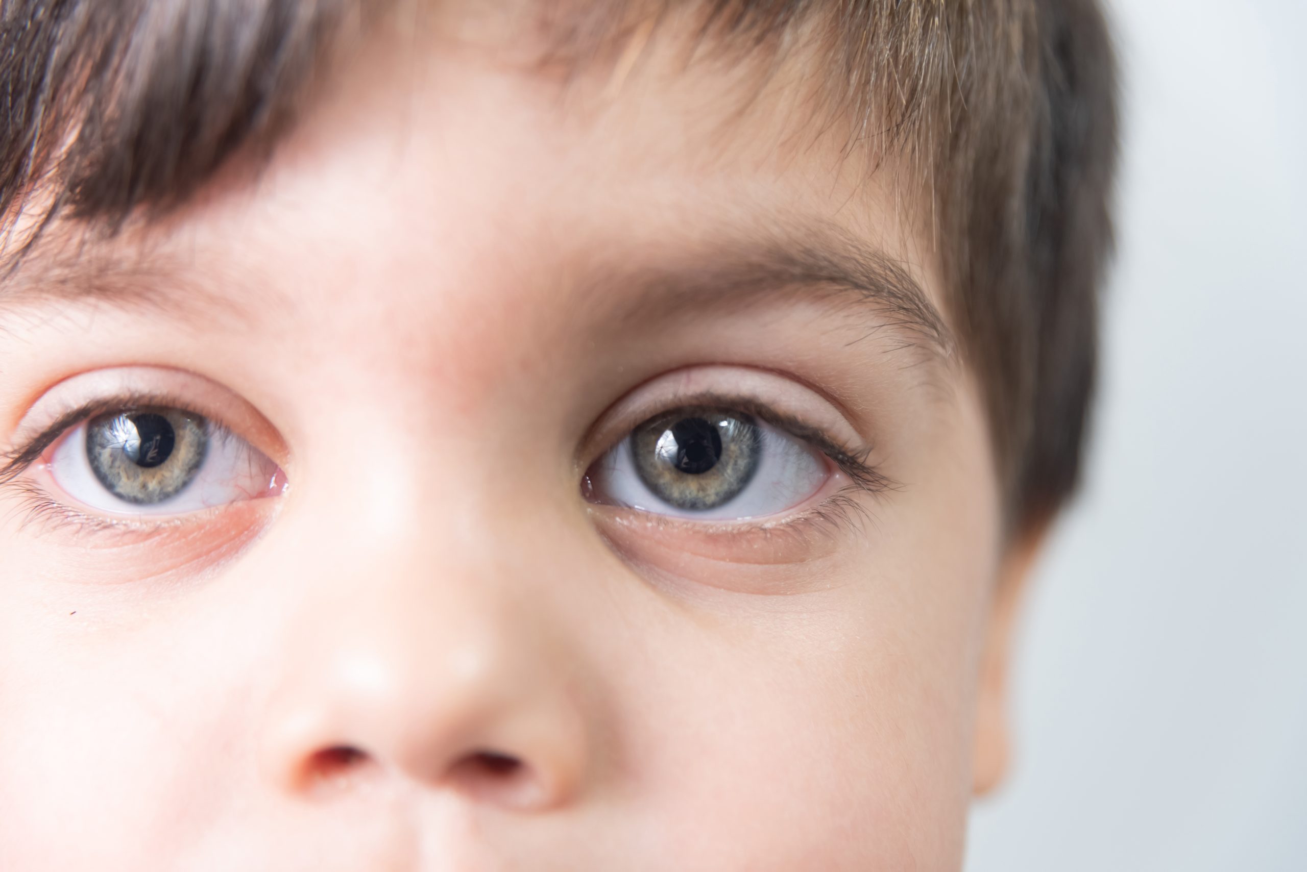 6 maneras de proteger los ojos de su hijo